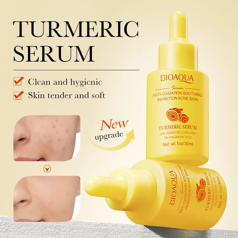 Set Bioaqua 6 Turmeric - Tratamiento Facial con Cúrcuma | Creativita